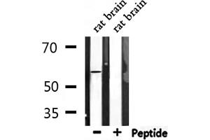 Western blot analysis of extracts from rat brain, using Phospho-ATF2 (Ser62/44) Antibody. (ATF2 anticorps  (pSer44, pSer62))