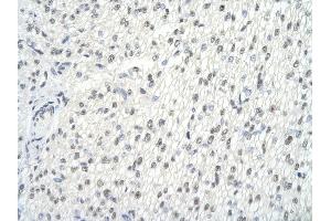 Rabbit Anti-GMEB2 antibody   Paraffin Embedded Tissue: Human Heart cell Cellular Data: cardiac cell of renal tubule Antibody Concentration: 4.