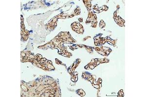 IHC analysis of ICAM1 using anti-ICAM1 antibody (ABIN5692991). (ICAM1 anticorps  (AA 28-268))