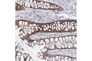 Immunohistochemical staining of human rectum with ARHGAP44 polyclonal antibody  shows strong cytoplasmic positivity in glandular cells. (ARHGAP44 anticorps)
