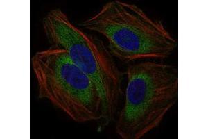 Immunofluorescence analysis of Hela cells using CD59 mouse mAb (green).
