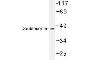 Image no. 2 for anti-Doublecortin (DCX) antibody (ABIN272098) (Doublecortin anticorps)
