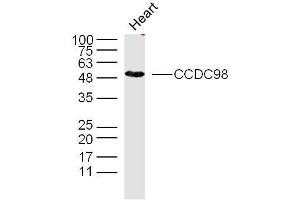 Mouse heart lysates probed with CCDC98 Polyclonal Antibody, unconjugated  at 1:300 overnight at 4°C followed by a conjugated secondary antibody at 1:10000 for 90 minutes at 37°C. (CCDC98 anticorps  (AA 51-150))