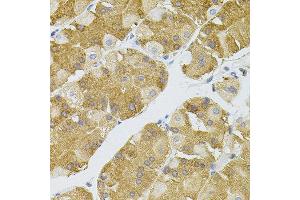 Immunohistochemistry of paraffin-embedded human stomach using NAT8 antibody.