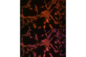 Immunofluorescence analysis of PC-12 cells using Thymidine Kinase 1 Rabbit pAb (ABIN6132726, ABIN6149198, ABIN6149199 and ABIN6221245) at dilution of 1:150 (40x lens).