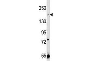 TRPM7 antibody western blot analysis in 293 lysate (TRPM7 anticorps  (AA 1821-1850))