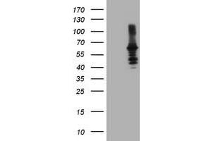 Western Blotting (WB) image for anti-Dystrobrevin, beta (DTNB) antibody (ABIN1497913)