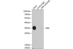 Immunoprecipitation analysis of 200 μg extracts of HeLa cells using 1 μg PPIE antibody . (PPIE anticorps  (AA 1-301))