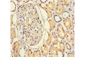 Immunohistochemistry of paraffin-embedded human kidney tissue using ABIN7161762 at dilution of 1:100 (NFIX anticorps  (AA 201-440))