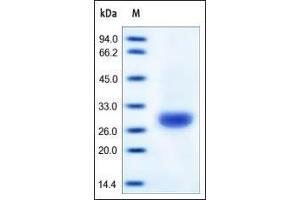 Human Carbonic Anhydrase II, His Tag on SDS-PAGE under reducing (R) condition.