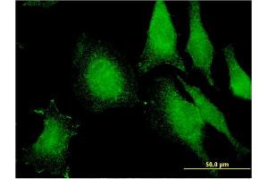 Immunofluorescence of monoclonal antibody to FIBP on HeLa cell. (FIBP anticorps  (AA 1-357))