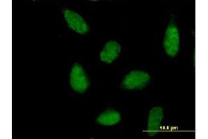 Immunofluorescence of purified MaxPab antibody to NR1H3 on HeLa cell.