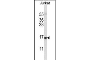 DDIT3 Antibody (Center) (ABIN656987 and ABIN2846170) western blot analysis in Jurkat cell line lysates (35 μg/lane). (DDIT3 anticorps  (AA 82-110))