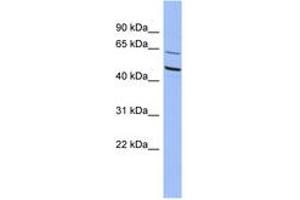 Image no. 1 for anti-Zinc Finger Protein 215 (ZNF215) (N-Term) antibody (ABIN6742821) (ZNF215 anticorps  (N-Term))