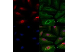 ABIN6264926 and ABIN6279887 staining  cells by IF/ICC.