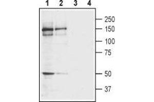 Western blot analysis of rat (lanes 1 and 3) and mouse (lanes 2 and 4) brain membranes: - 1,2.