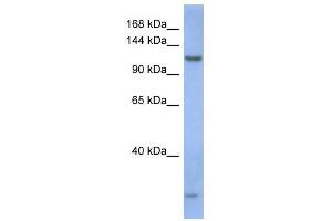 PIWIL1 antibody used at 1 ug/ml to detect target protein.