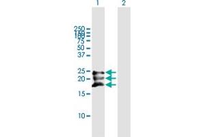 Western Blot analysis of BST2 expression in transfected 293T cell line by BST2 MaxPab polyclonal antibody.
