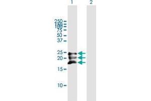 Western Blot analysis of BST2 expression in transfected 293T cell line by BST2 MaxPab polyclonal antibody. (BST2 anticorps  (AA 1-180))