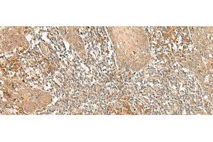 Immunohistochemistry of paraffin-embedded Human tonsil tissue using WLS Polyclonal Antibody at dilution of 1:50(x200) (GPR177/WLS anticorps)