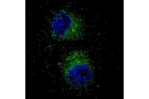 Immunofluorescence (IF) image for anti-Met Proto-Oncogene (MET) antibody (ABIN2995276) (c-MET anticorps)
