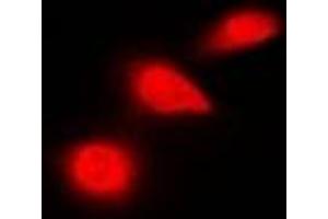 Immunofluorescent analysis of p53 staining in HeLa cells. (p53 anticorps  (C-Term))