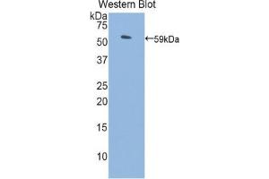 Western blot analysis of the recombinant protein. (PROS1 anticorps  (AA 261-496))
