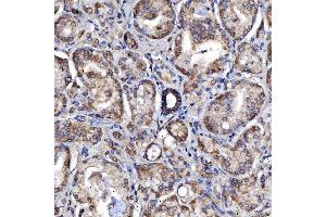 IHC analysis of SARS2 using anti-SARS2 antibody (ABIN7601804). (SARS2 anticorps  (AA 46-518))