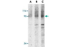 Western blot analysis of NOD2 in Jurkat cell lysate with NOD2 polyclonal antibody  at (A) 1, (B) 2 and (C) 4 ug/mL . (NOD2 anticorps  (N-Term))