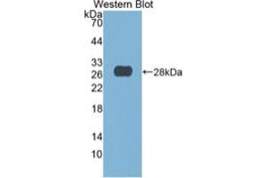 WB of Protein Standard: different control antibodies against Highly purified E. (DNASE1 Kit ELISA)