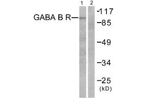 Western Blotting (WB) image for anti-GABA B Receptor (C-Term) antibody (ABIN1848554)