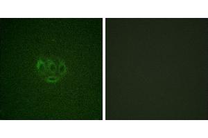 Immunofluorescence analysis of A549 cells, using ACK1 (Phospho-Tyr284) antibody. (TNK2 anticorps  (pTyr284))