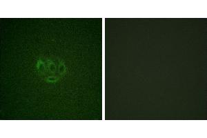 Immunofluorescence analysis of A549 cells, using ACK1 (Phospho-Tyr284) antibody.
