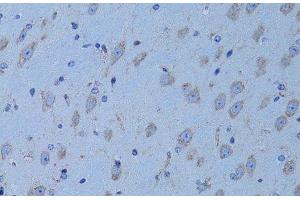 Immunohistochemistry of paraffin-embedded Mouse brain using HADH Polyclonal Antibody at dilution of 1:100 (40x lens). (HADH anticorps)