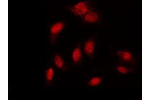 ABIN6267396 staining K562 by IF/ICC. (GATA1 anticorps  (pSer310))