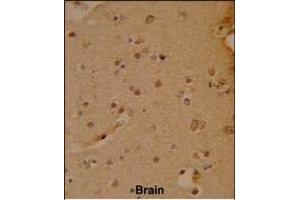 Formalin-fixed and paraffin-embedded human brain reacted with SOX4 Antibody (N-term), which was peroxidase-conjugated to the secondary antibody, followed by DAB staining. (SOX4 anticorps  (N-Term))