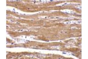 Immunohistochemistry of BACE2 in mouse heart with BACE2 antibody at 10 μg/ml.