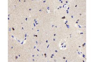 Immunohistochemistry analysis of paraffin-embedded rat brain using TSC22D3 Polyclonal Antibody at dilution of 1:300.