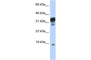 WB Suggested Anti-PXT1 Antibody Titration: 0. (PXT1 anticorps  (Middle Region))