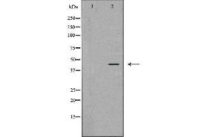 Western blot analysis of MCF-7  lysate using ATXN3 antibody. (Ataxin 3 anticorps  (Internal Region))