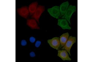 ABIN6258165 and ABIN6275959 staining Hela cells(45 min of heat-shock) by IF/ICC.