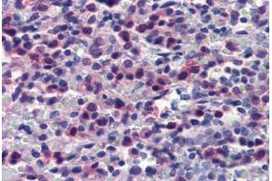 Human Spleen (formalin-fixed, paraffin-embedded) stained with CASP7 antibody ABIN462357 followed by biotinylated anti-mouse IgG secondary antibody ABIN481714, alkaline phosphatase-streptavidin and chromogen. (Caspase 7 anticorps)