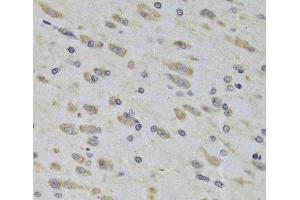 Immunohistochemistry of paraffin-embedded Rat brain using RPL3 Polyclonal Antibody at dilution of 1:100 (40x lens).