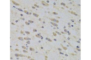 Immunohistochemistry of paraffin-embedded Rat brain using RPL3 Polyclonal Antibody at dilution of 1:100 (40x lens). (RPL3 anticorps)