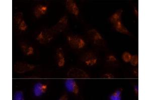 Immunofluorescence analysis of U-2 OS cells using SEC14L2 Polyclonal Antibody at dilution of 1:100 (40x lens). (SEC14L2 anticorps)