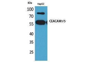 Western Blotting (WB) image for anti-Carcinoembryonic Antigen-Related Cell Adhesion Molecule 1/5 (CEACAM1/5) (N-Term) antibody (ABIN3178236) (CEACAM1/5 anticorps  (N-Term))