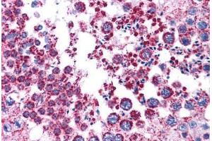 Human Testis: Formalin-Fixed, Paraffin-Embedded (FFPE)