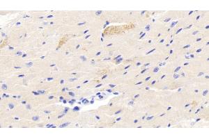 Detection of FSTL3 in Mouse Cardiac Muscle Tissue using Polyclonal Antibody to Follistatin Like Protein 3 (FSTL3)