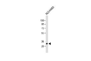 All lanes : Anti-VDAC3 Antibody (Center) at 1:1000 dilution Lane 1: Human heart lysate Lane 2: NCI- whole cell lysate Lane 3: A431 whole cell lysate Lane 4: U-2OS whole cell lysate Lane 5: Mouse testis lysate Lane 6: Rat brain lysate Lysates/proteins at 20 μg per lane.