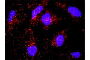 Proximity Ligation Analysis of protein-protein interactions between PECAM1 and CTNNB1.